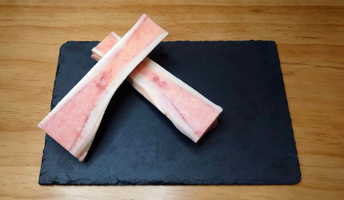 ANB Bone Marrow