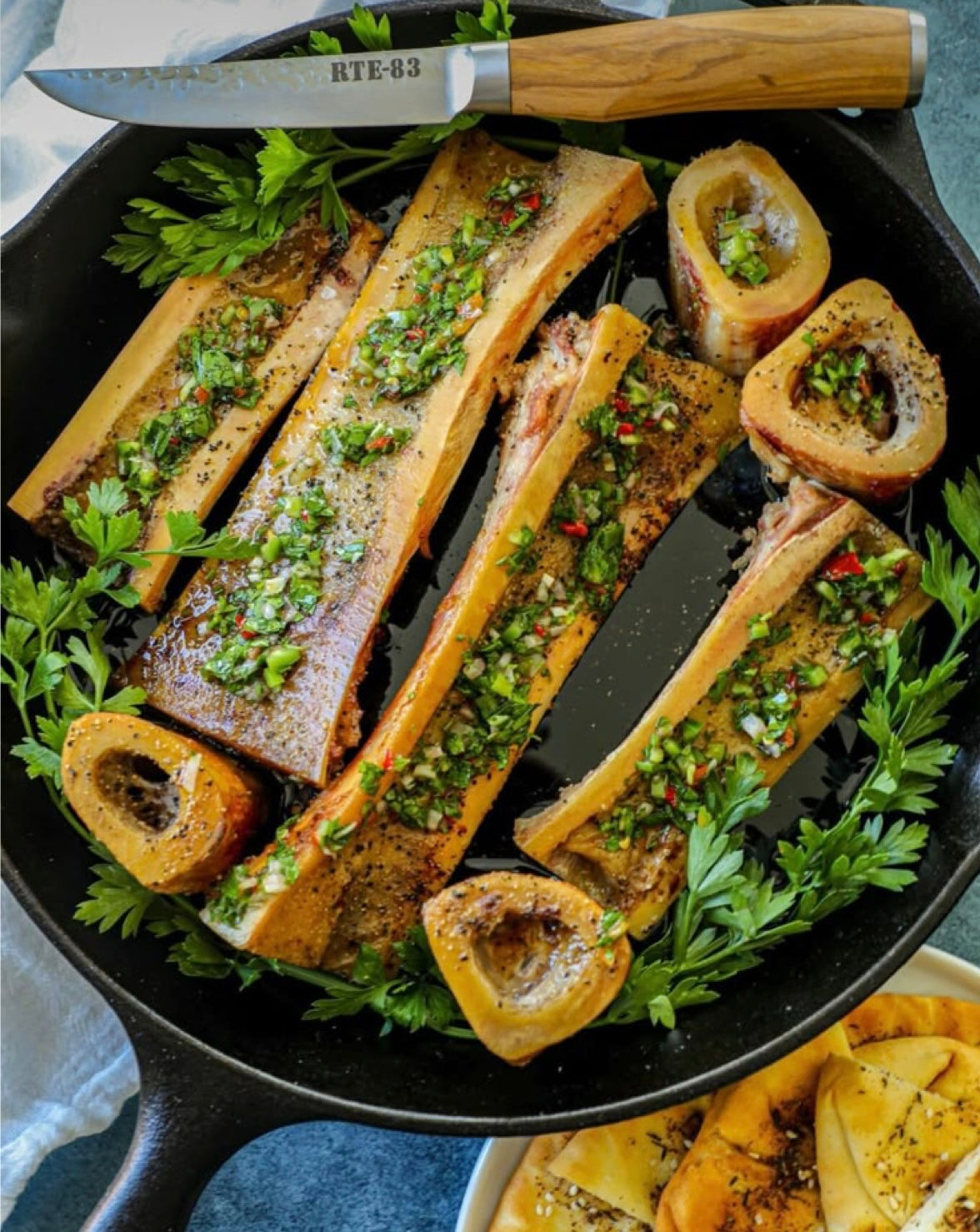 ANB Bone Marrow